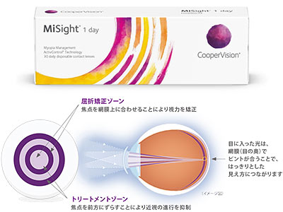 マイサイトワンデーってなに？